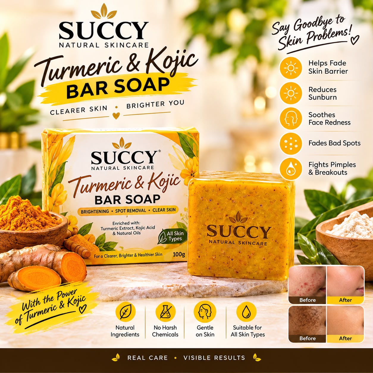 Succy Turmeric & Kojic Bar Soap
